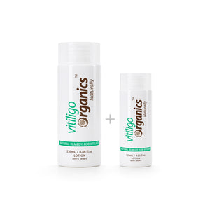 VO 375ml / 25.36 fl oz - Vitiligo Organics