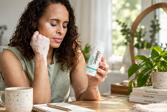 How to Buy Natural Vitiligo Cream With Confidence