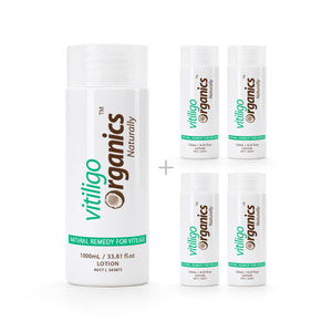 VO 750ml / 50.72 fl oz - Vitiligo Organics