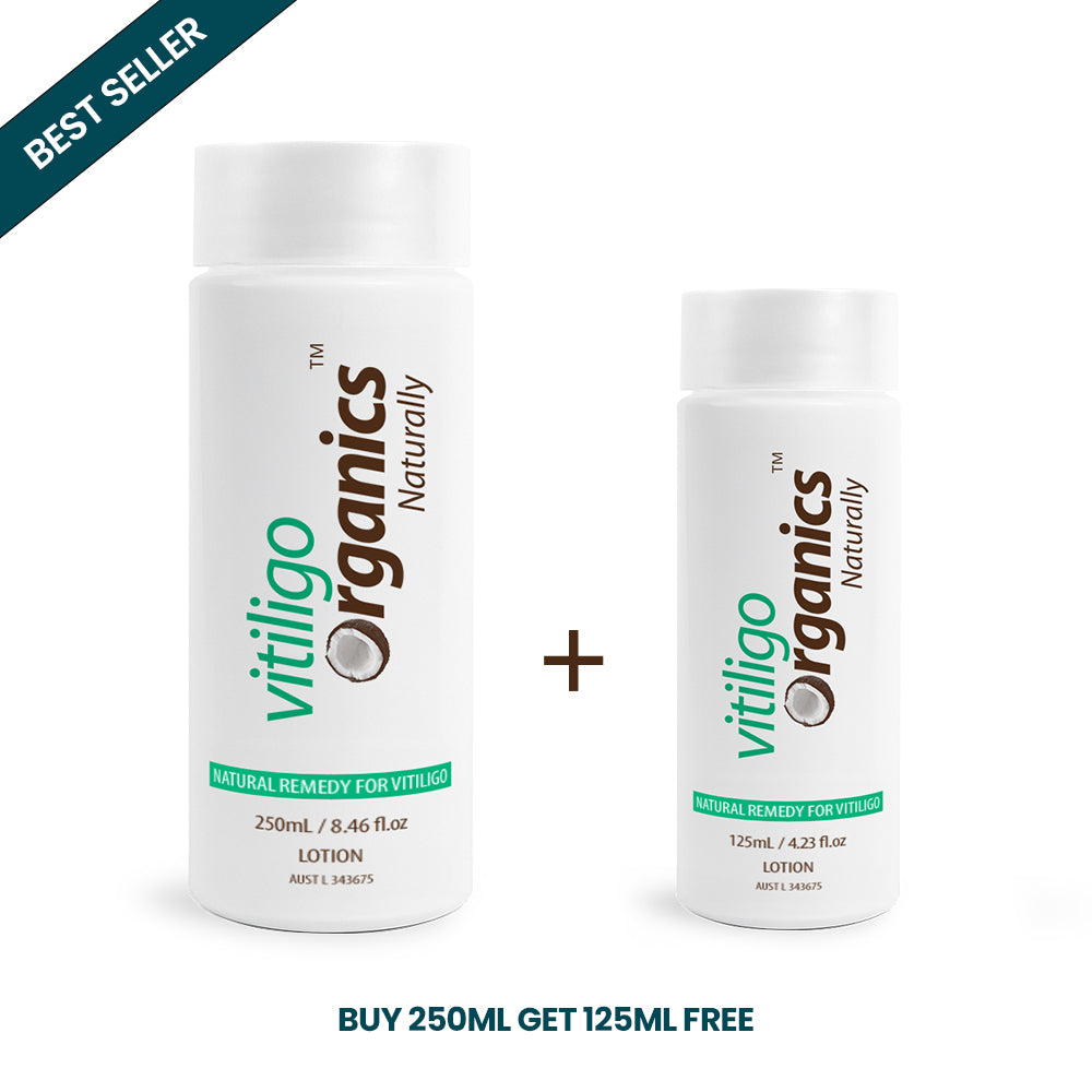 Vitiligo Organics 375ml / 12.68 fl oz