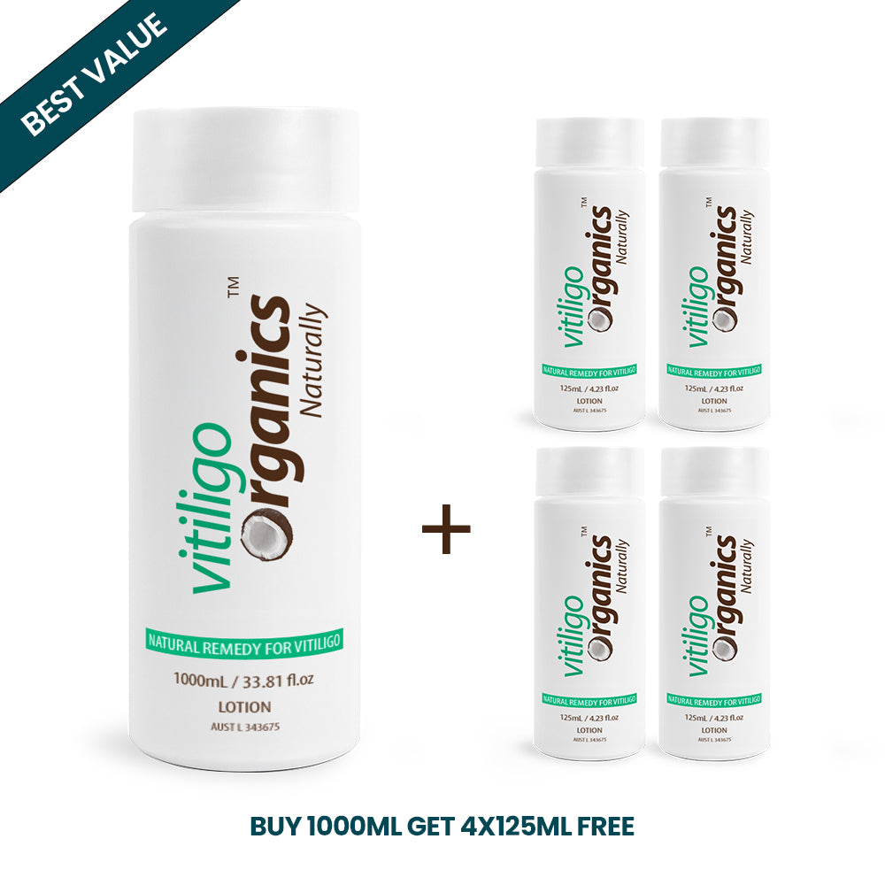 Vitiligo Organics 1500ml / 50.72 fl oz